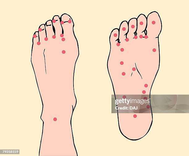 stockillustraties, clipart, cartoons en iconen met acupressure points of feet, close up - pressure point