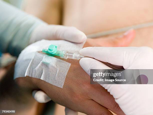 a intravenous drip being attached to a hand - catheter stock pictures, royalty-free photos & images