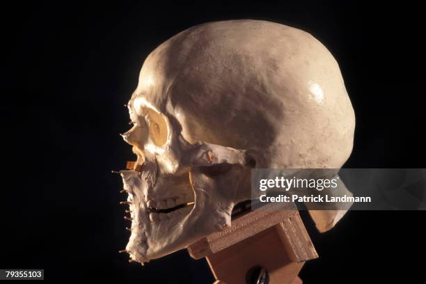 Numbered pegs placed on a model of Otzi's skull represent the layers of fatty tissue matching the anthropological norms for his age, sex and body...