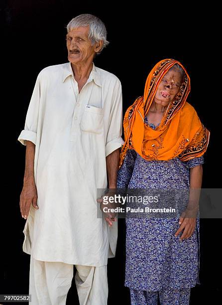 Bashiran Bibi from Sukhiki in the Punjab region poses with her husband showing a face that is severly deformed from her burns June 24, 2007 in...