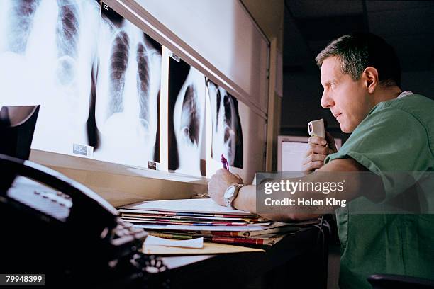 radiologist examining x-rays - radiogram photographic image fotografías e imágenes de stock