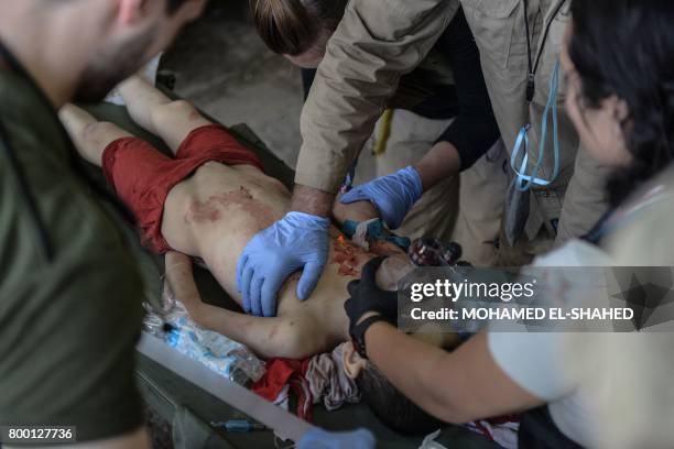 An Iraqi boy, who suffered injuries following a suicide attack as he was escaping the Old City of Mosul, receives treatment at a field hospital on...