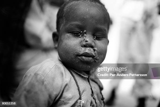 Malnourished child waits in a queue outside a clinic in the Oure Cassoni refugee camp on July 26, 2007 about 23 kilometers outside Bahai, Chad. Since...