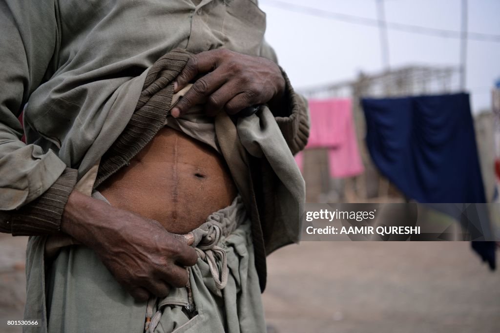 PAKISTAN-ILLEGAL-ORGANS-TRADE-HEALTH-SOCIAL