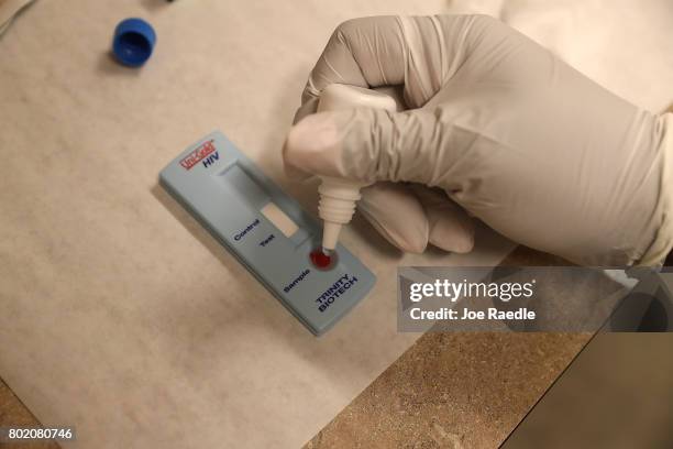 Medical assistant tests blood drawn from a patient on National HIV Testing Day at a Planned Parenthood health center on June 27, 2017 in Miami,...