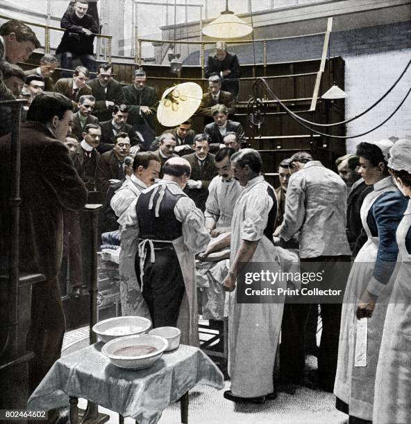 An operation at Charing Cross Hospital, London, 1901 . A team of surgeons work on a patient in the operating theatre of Charing Cross Hospital while...