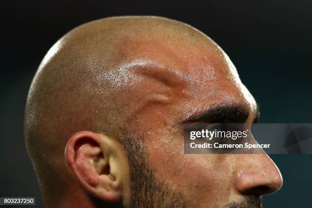 Tim Mannah of the Eels leaves the field with a haematoma during the round 17 NRL match between the Parramatta Eels and the Canterbury Bulldogs at ANZ...