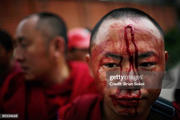 Blood flows from the forehead of aTibetan monk beaten by police during a Tibetan peace rally in front of the United Nations building on March 17,...