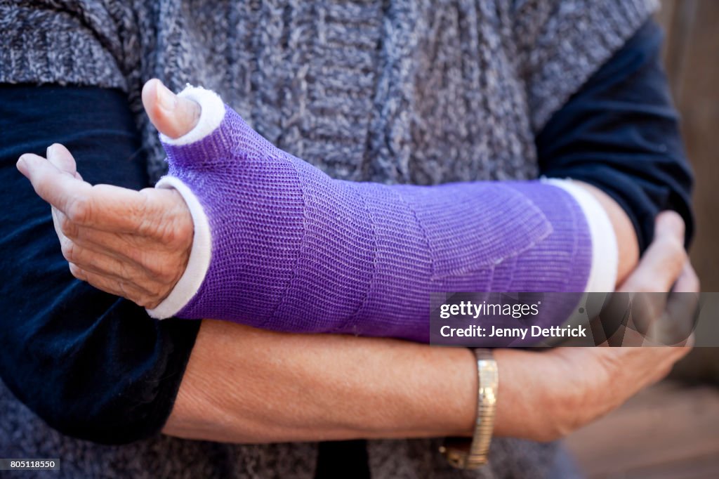 Broken arm