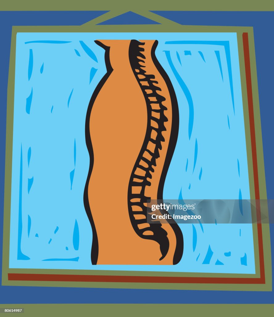 Illustration of a spine