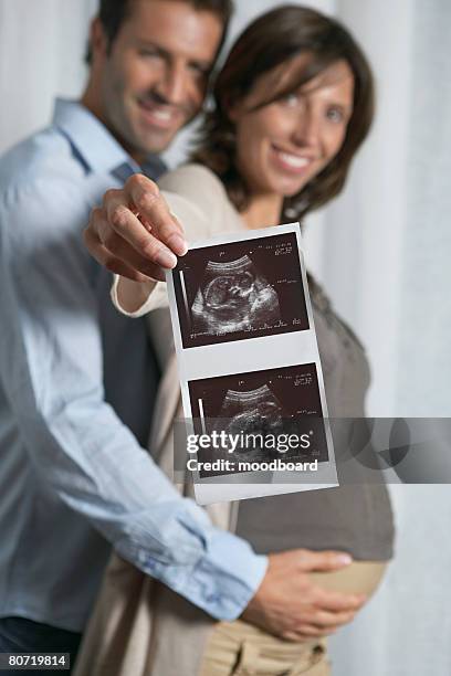 expecting couple with sonogram - ultra sonography stock pictures, royalty-free photos & images