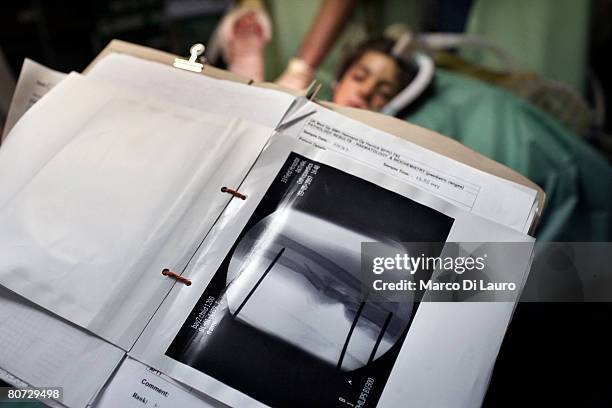 The x-ray of Malalia's arm prior her surgery in the operating theatre on June 9, 2007 at the British Army Field Hospital at Camp Bastion in a...