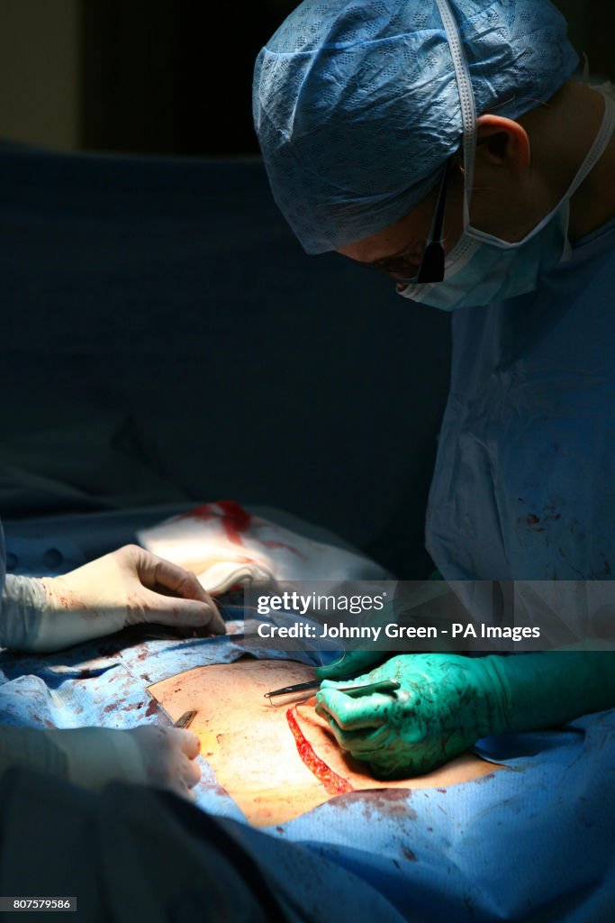 Barts Cancer Centre opens