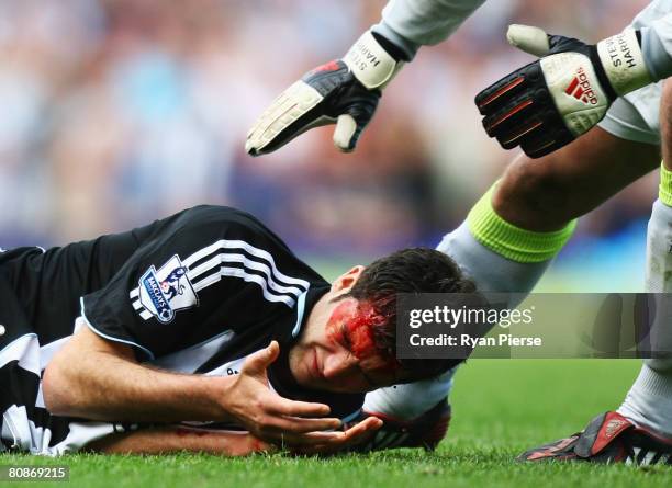 David Edgar of Newcastle United looks at his hand as blood pours from a cut during the Barclays Premier League match between West Ham United and...