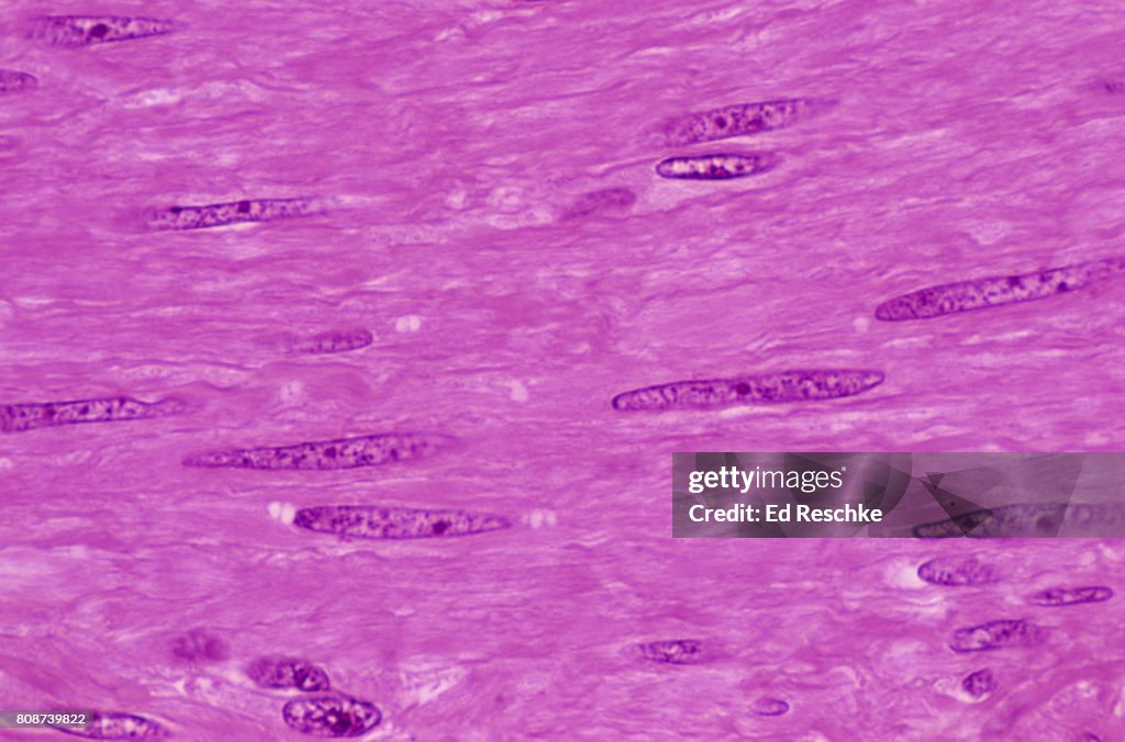 Smooth Muscle, Human Uterus