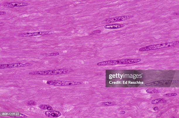 smooth muscle, human uterus - 平滑筋 ストックフォトと画像