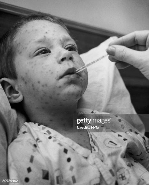 Four year-old boy with chicken pox has his temperature taken, circa 1955.