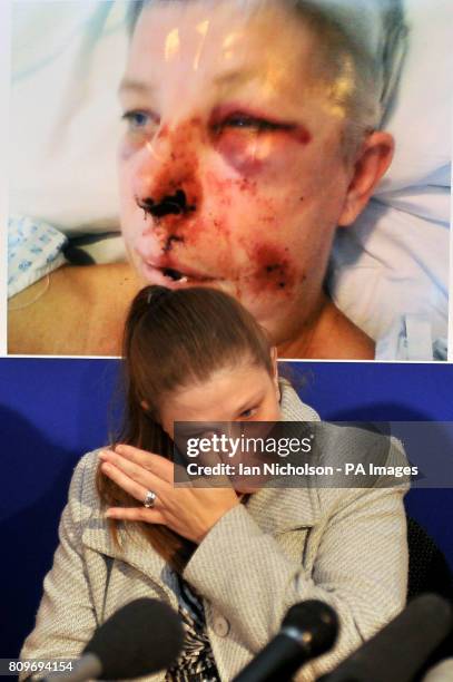 Michelle Manley addresses a press conference at Essex Police Headquarters to appeal for information into an incident on the A12 after a concrete...