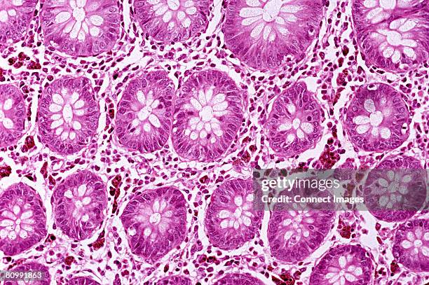 colon - parts of human cells stock-fotos und bilder