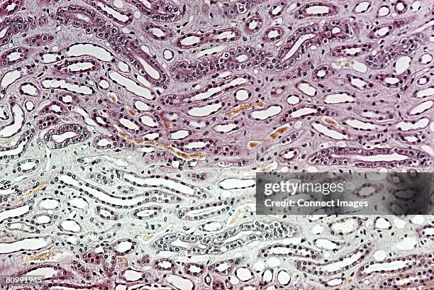kidney - tubule stock pictures, royalty-free photos & images