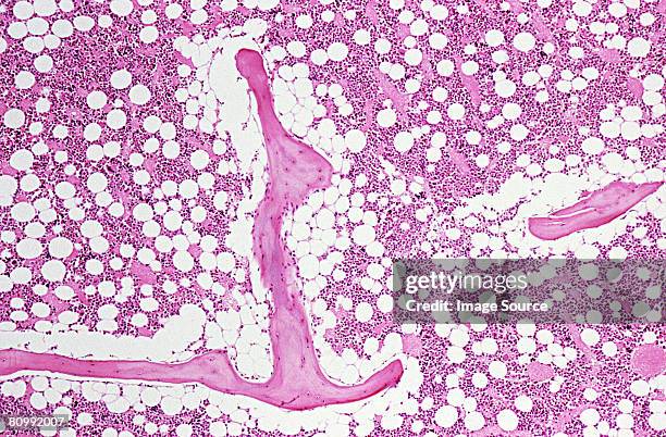 bone marrow - bone marrow stock pictures, royalty-free photos & images