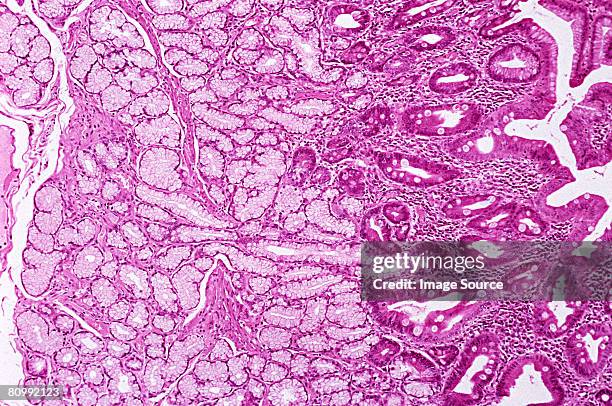 brunners glands in duodenum - menselijke twaalfvingerige darm stockfoto's en -beelden