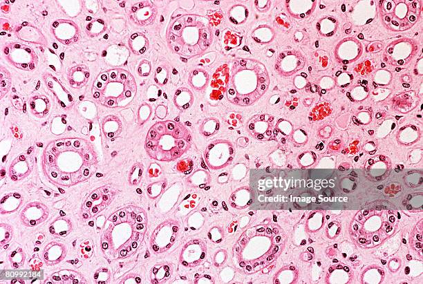 kidney - micrografía científica fotografías e imágenes de stock