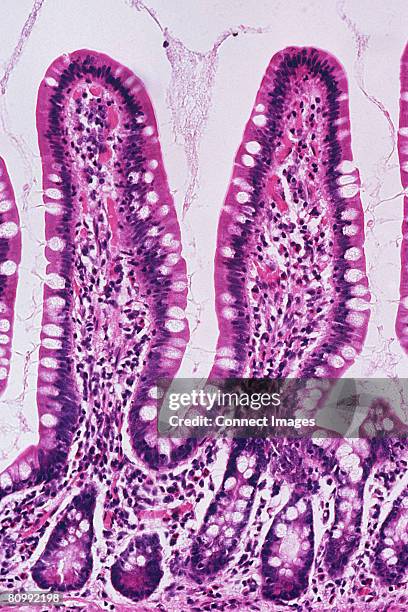 ileum - villus stock pictures, royalty-free photos & images