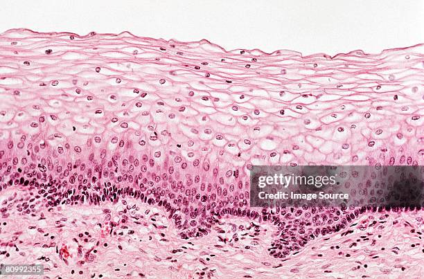ectocervical epithelium  - epitelio imagens e fotografias de stock