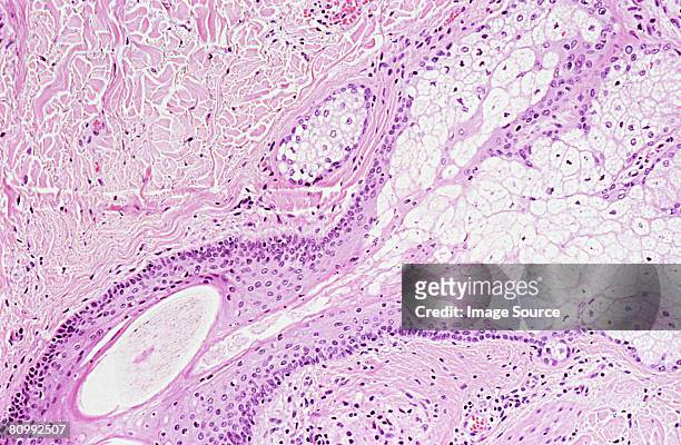 skin cells - micrografía científica fotografías e imágenes de stock