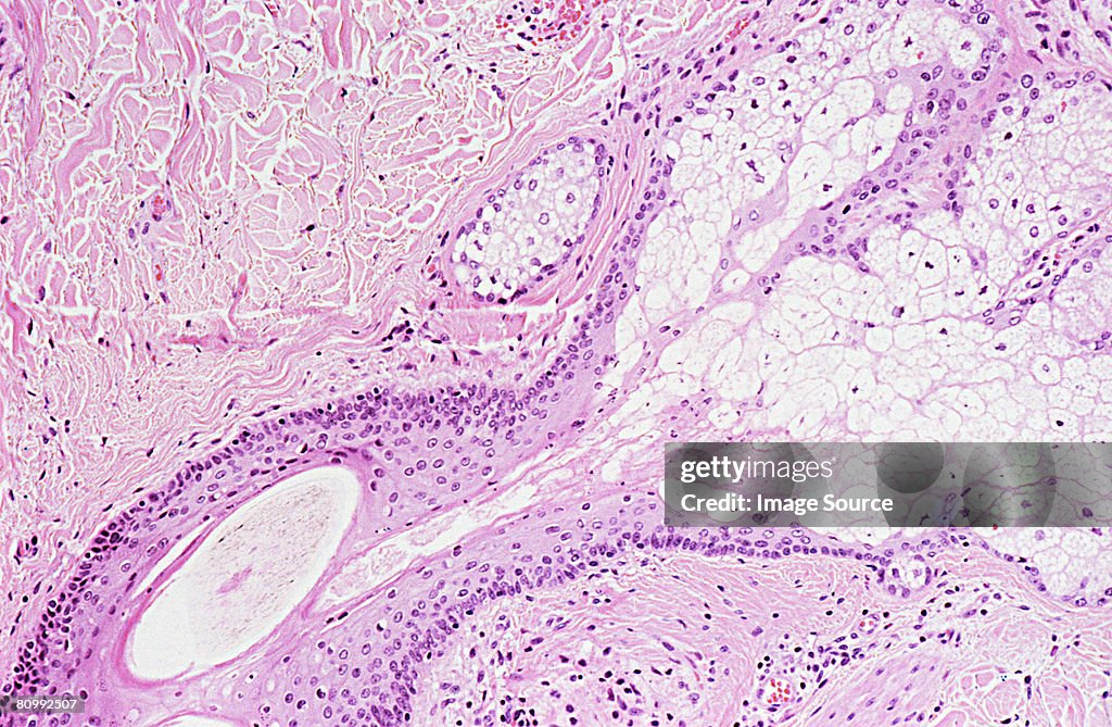 Use Skin Cells Skin Cells High-Res Stock Photo - Getty Images