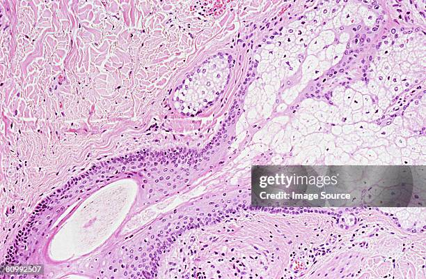 skin cells - människohud bildbanksfoton och bilder