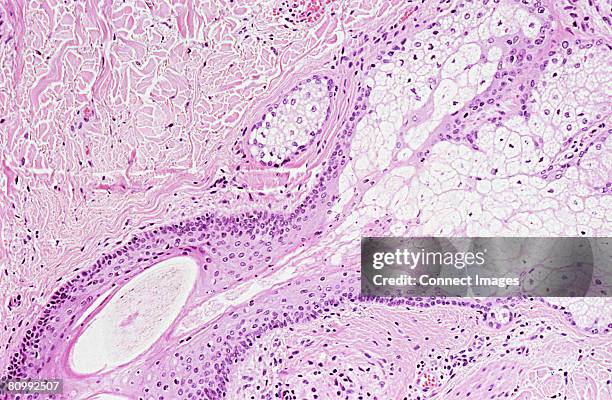 Skin Cells, 照片檔