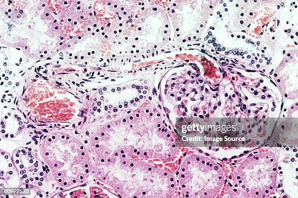 kidney - arterioles stock pictures, royalty-free photos & images