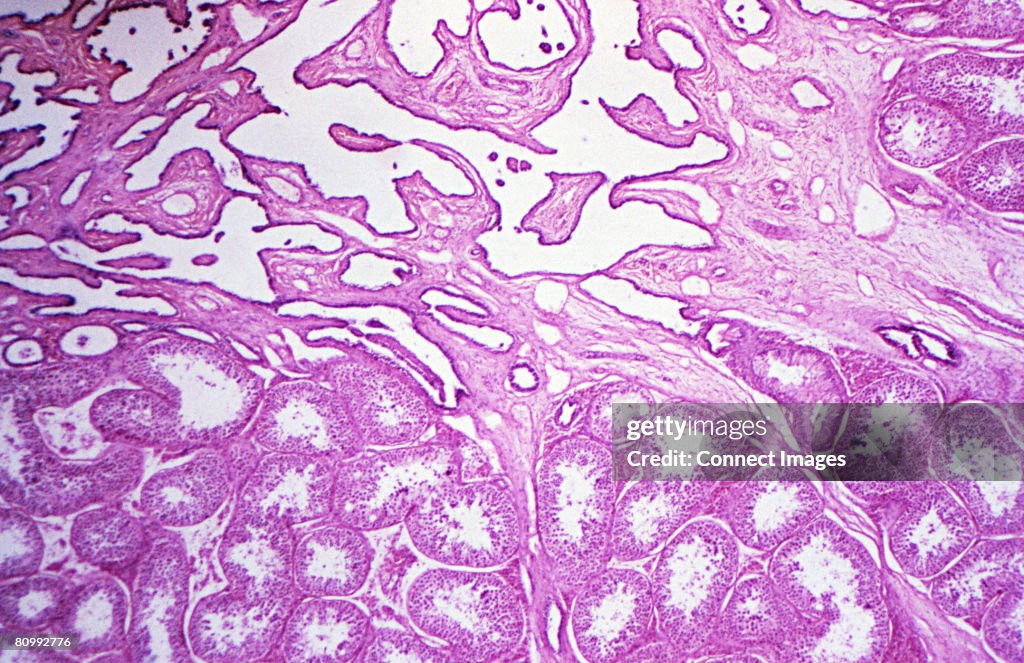 Testis
