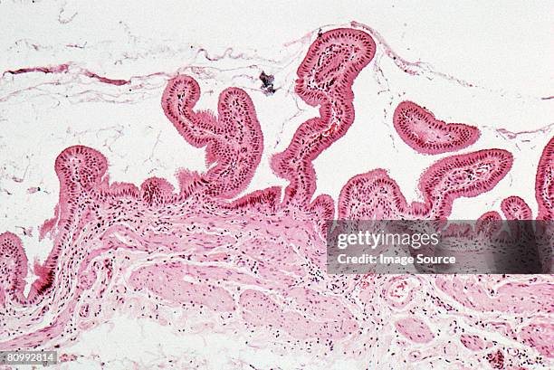 bone marrow - beenmerg bot stockfoto's en -beelden