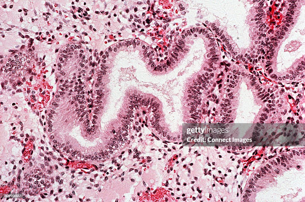 Endometrium