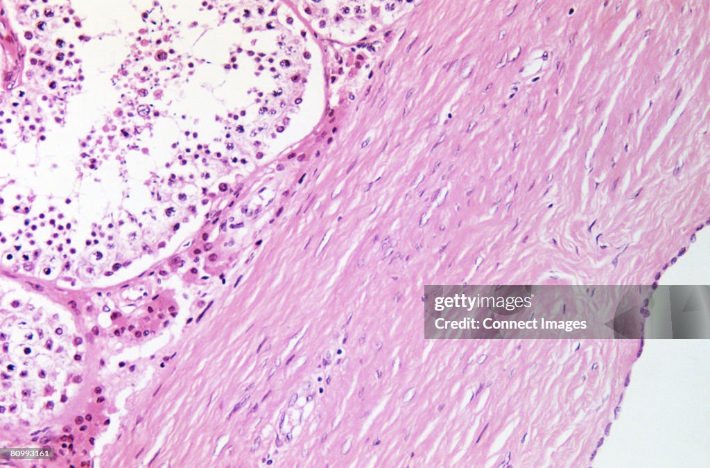 Testis