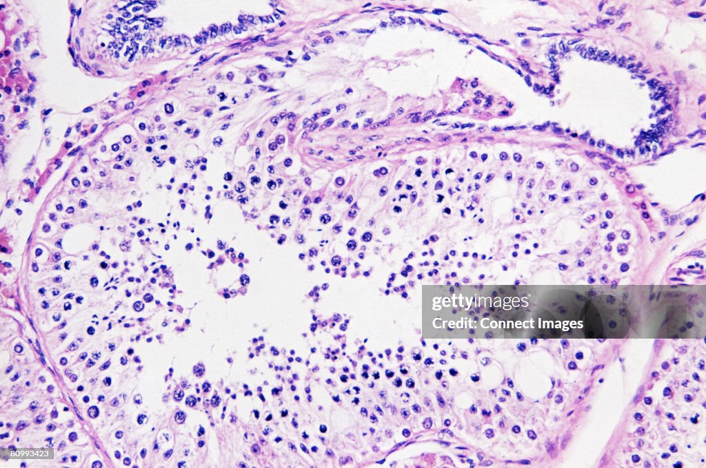 Testis