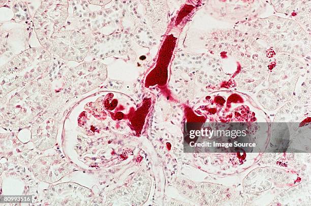 kidney - arterioles stock pictures, royalty-free photos & images