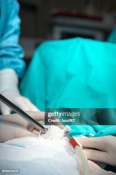 doctors in scrubs operating on a patient using instruments - surgical pin stock pictures, royalty-free photos & images