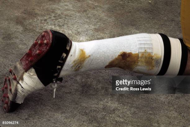 Pittsburgh Steelers player's leg has some "stick 'em" on the inside of the socks during the Steelers 13-7 victory over the Oakland Raiders in the...