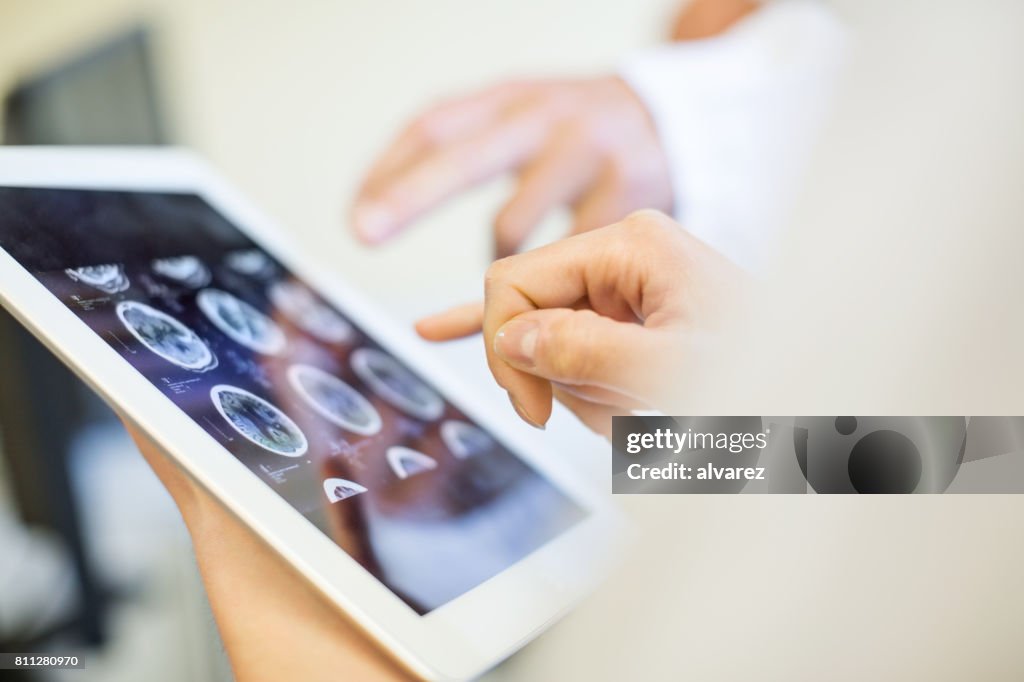 Medical team analyzing MRI scans on digital tablet