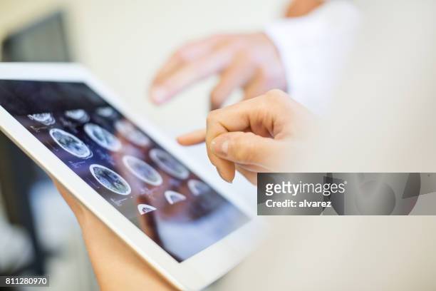 medical team analyzing mri scans on digital tablet - medical technical equipment stock pictures, royalty-free photos & images