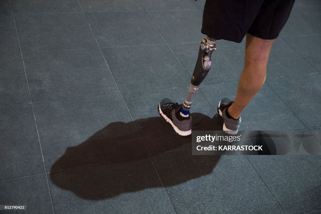 Man with leg amputated in the gym
