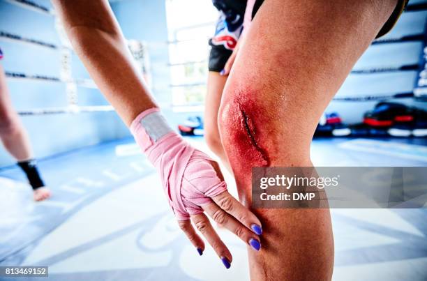 mujer combatiente con la rodilla lesionada en gimnasio - boxing media workouts fotografías e imágenes de stock