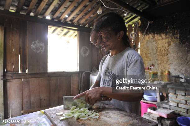 Chi Zhoujing cooks at home in the remote Shangfeng village on June 21, 2017 in Minqing, China. The 24-year-old man developed tumors on his head...