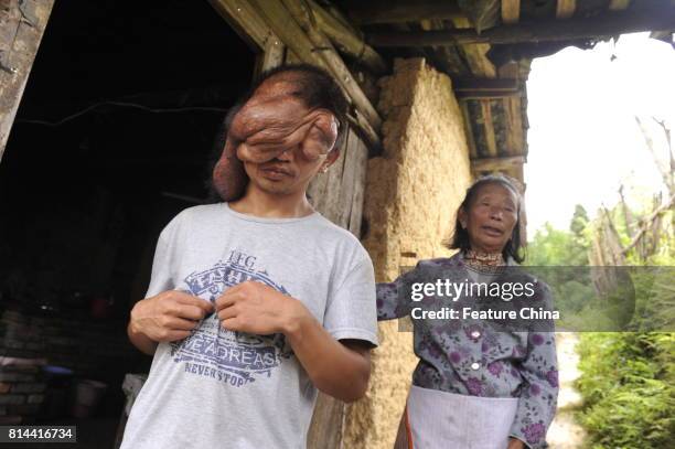 Chi Zhoujing stays with his granny at home in the remote Shangfeng village in Minqing county on June 21, 2017 in Minqing, China.. The 24-year-old man...