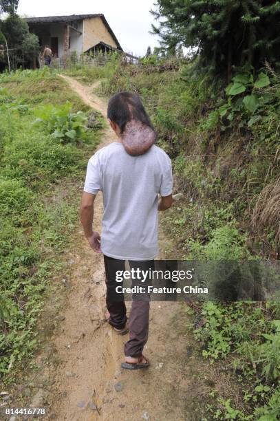 Chi Zhoujing walks outside his home in the remote Shangfeng village in Minqing county on June 21, 2017 in Minqing, China.. The 24-year-old man...