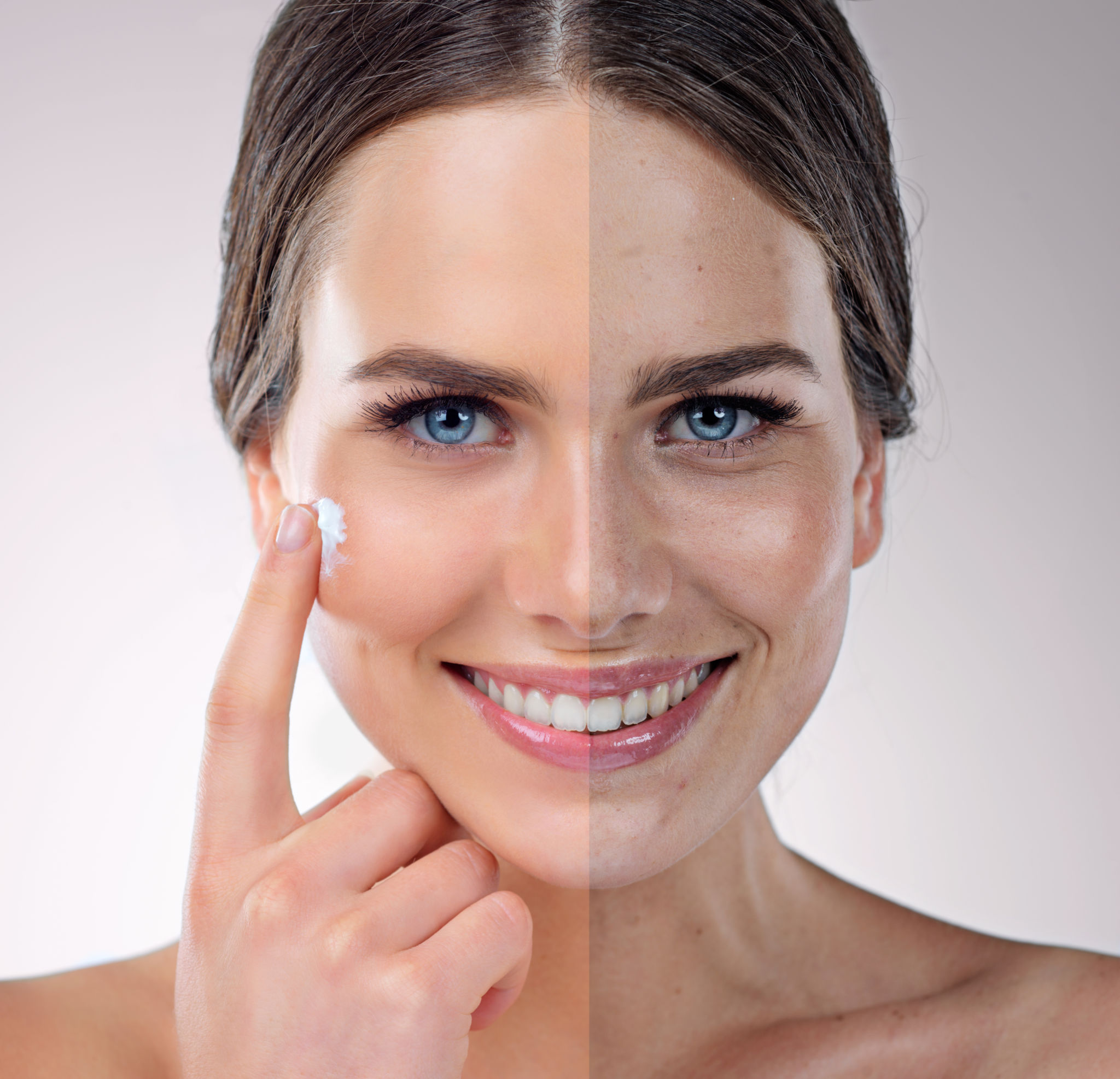 skincare transformation